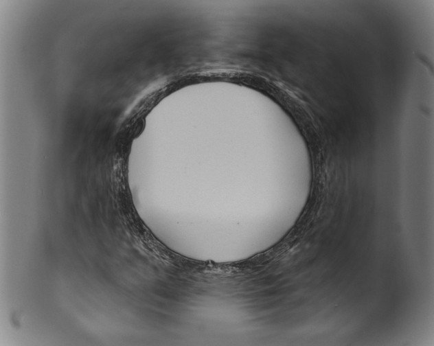 X0000099441351200806061034