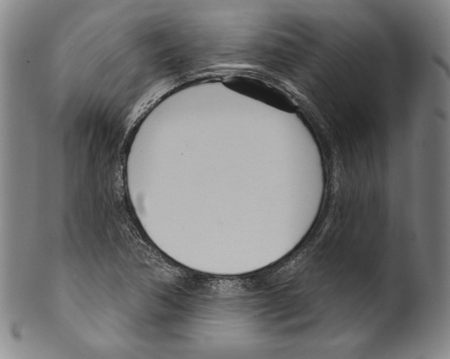 X0000099441362200806061033