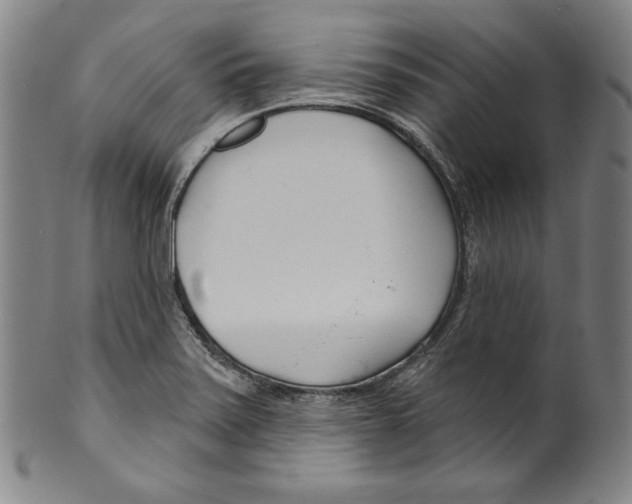 X0000099441371200806061033