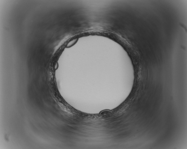 X0000099441400200806061032