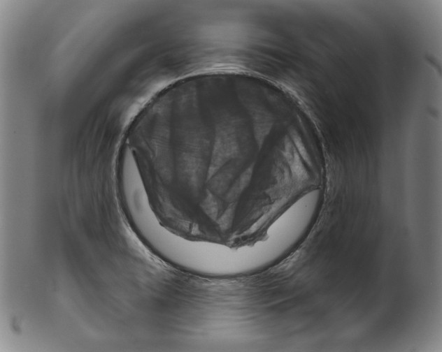 X0000099441422200806061033