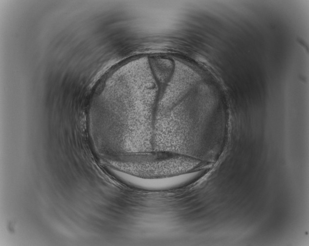 X0000099441449200806061032