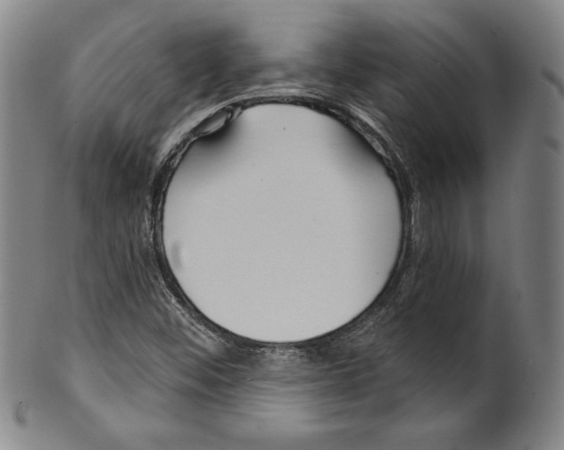 X0000099441452200806061032