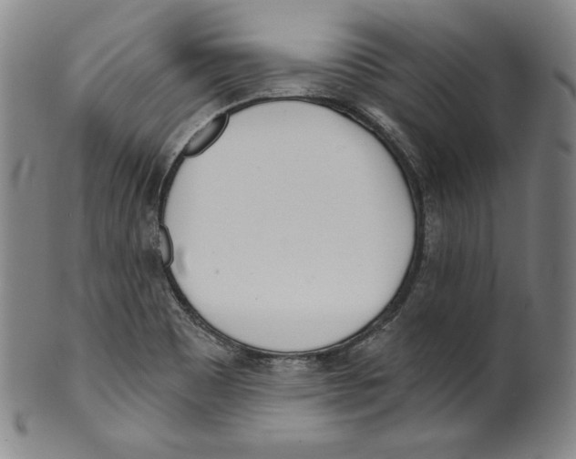 X0000099441465200806061032