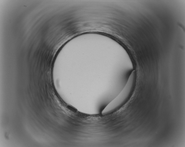 X0000099441513200806061031