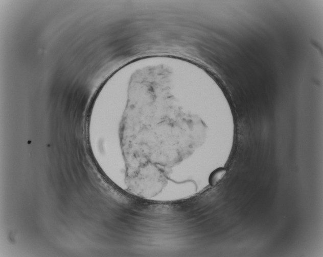 X0000099441517200806061031