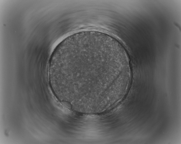 X0000099441522200806061031