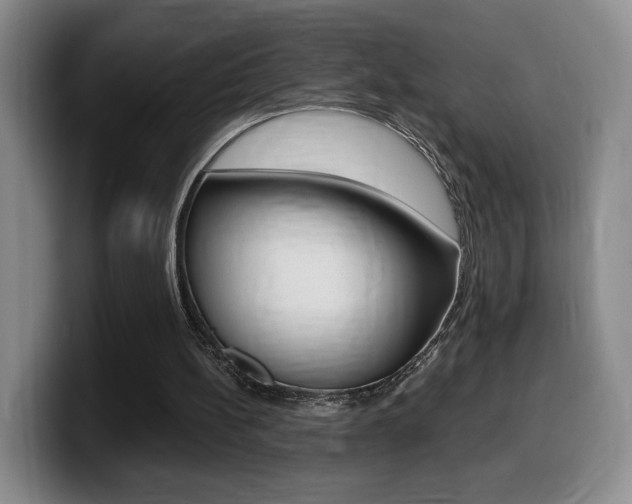 X0000099450148200805090734