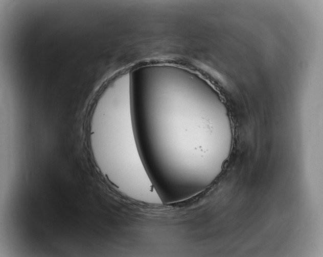 X0000099451160200805090722