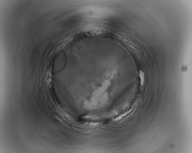 X0000099451011200805091501