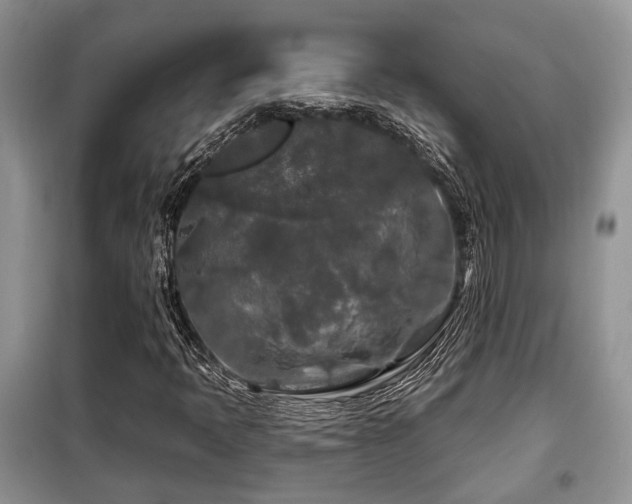 X0000099451397200805091456