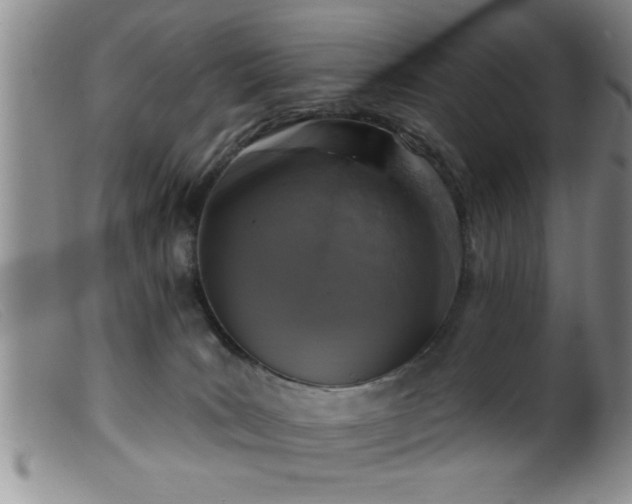 X0000099450035200805161033