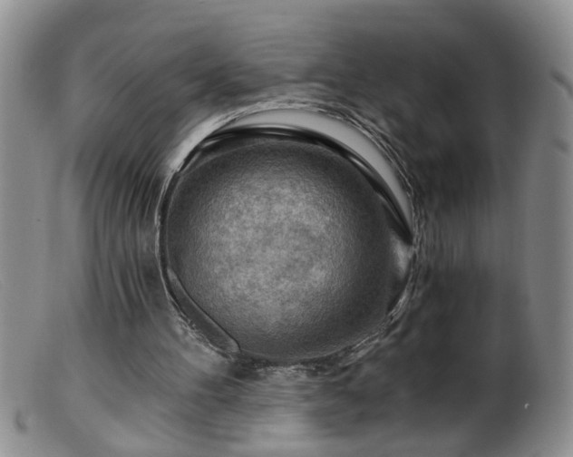 X0000099450100200805161032