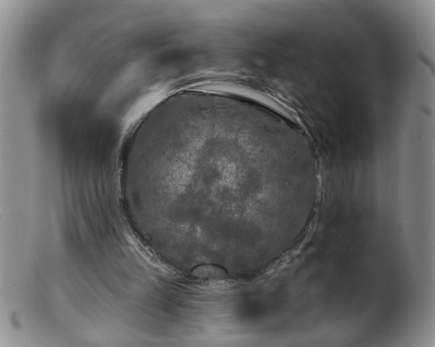 X0000099450149200805161030