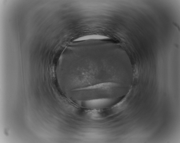 X0000099450182200805161031