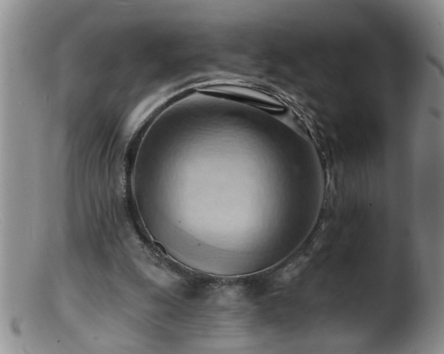 X0000099450247200805161029