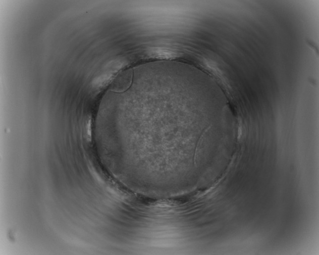 X0000099450358200805161028