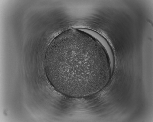 X0000099450385200805161027