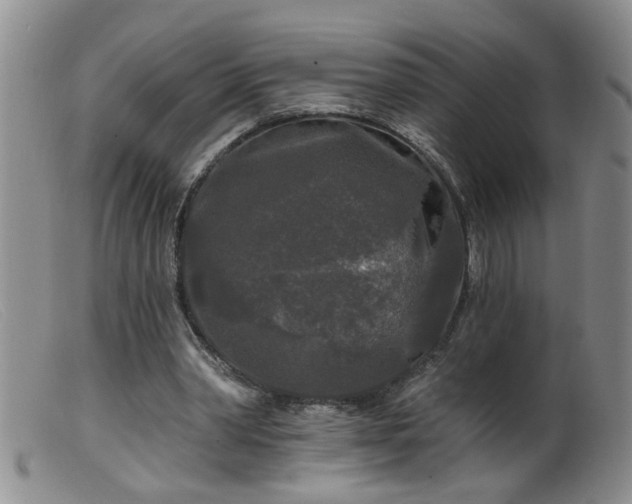 X0000099450390200805161027