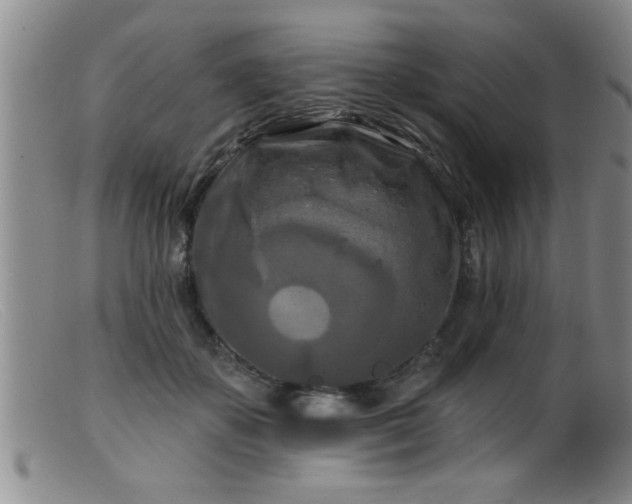 X0000099450507200805161025