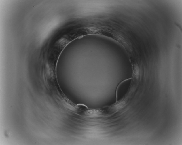 X0000099450526200805161025