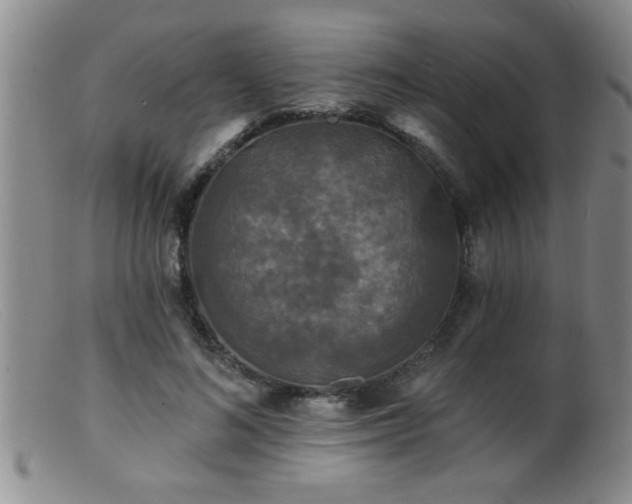 X0000099450692200805161022