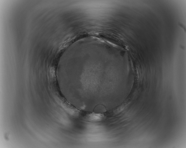 X0000099450711200805161022