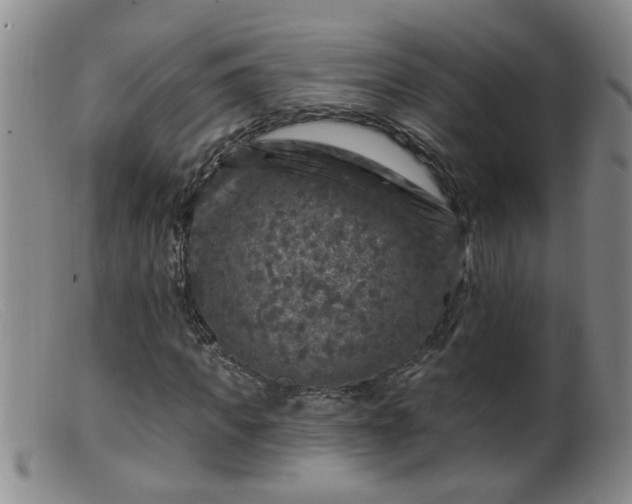 X0000099450917200805161018