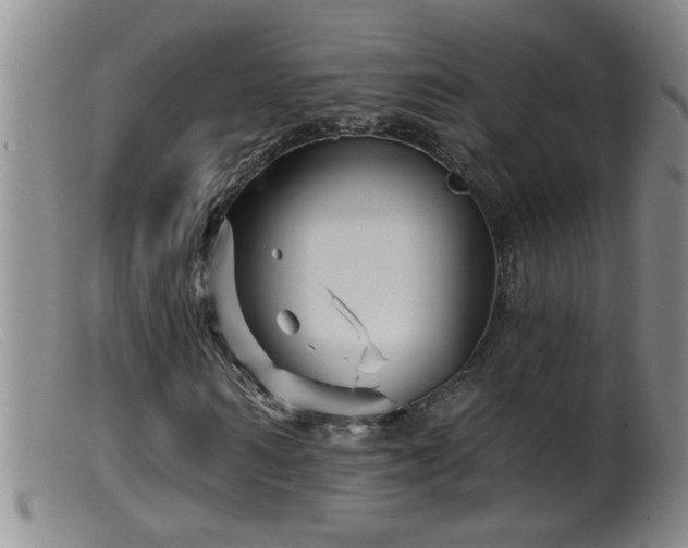 X0000099450962200805161018