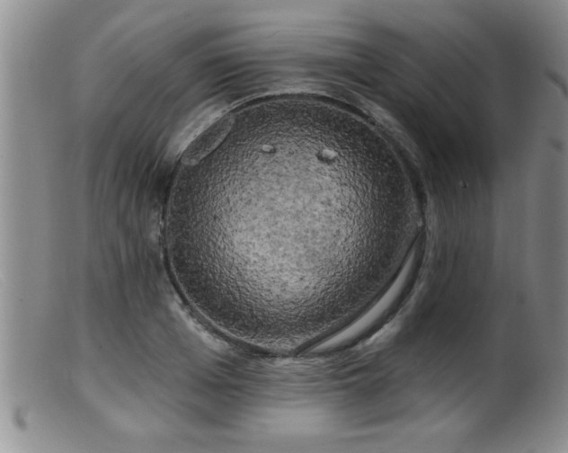 X0000099450985200805161018