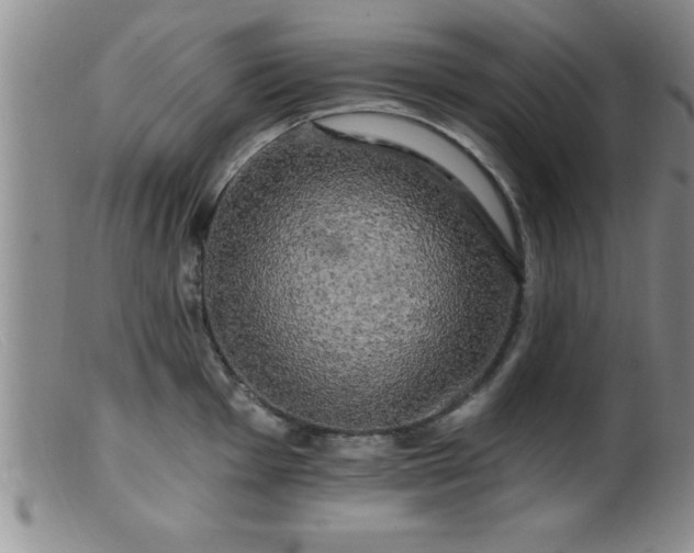 X0000099451001200805161018