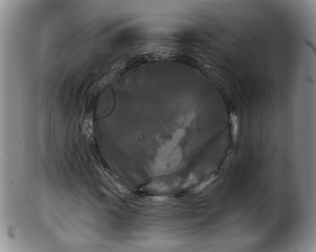 X0000099451011200805161017