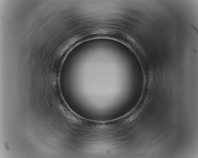 X0000099451017200805161017