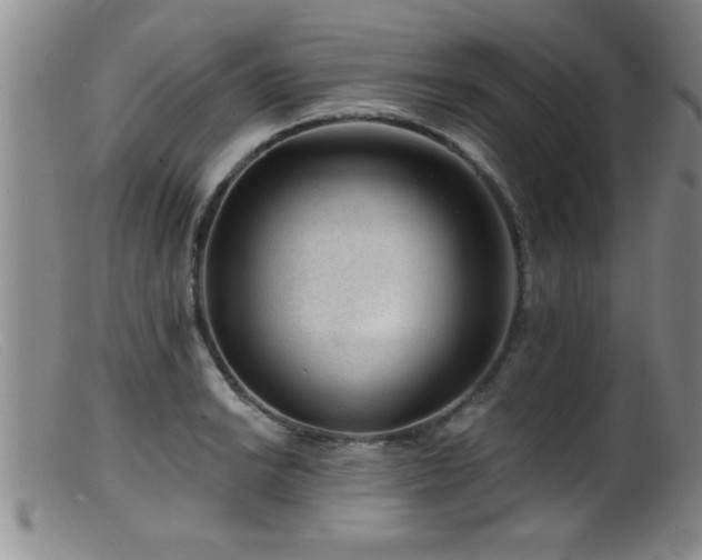 X0000099451038200805161017