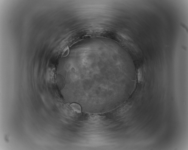 X0000099451059200805161017