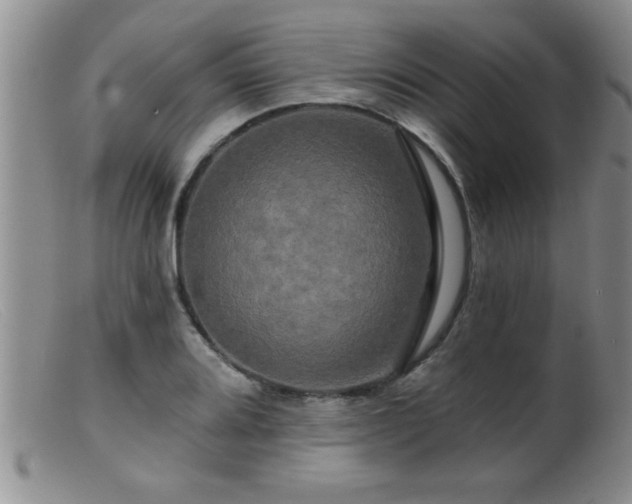 X0000099451080200805161016