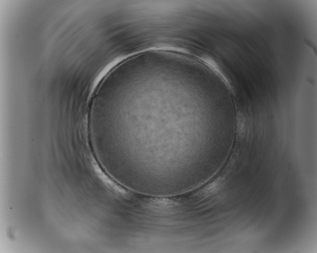 X0000099451100200805161016