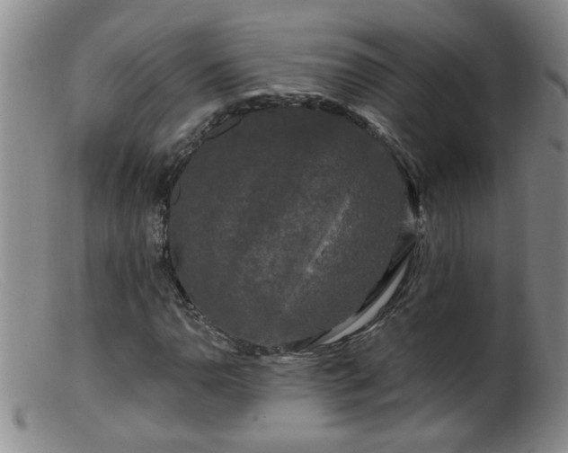 X0000099451110200805161015