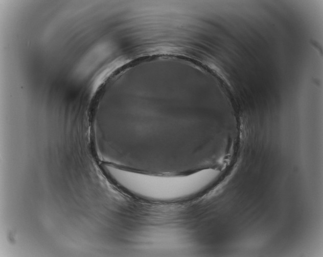 X0000099451117200805161015