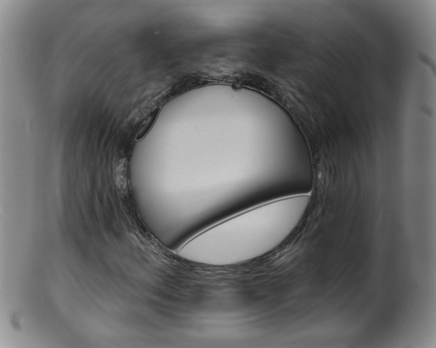 X0000099451156200805161015