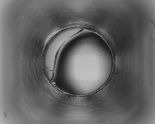 X0000099451164200805161015