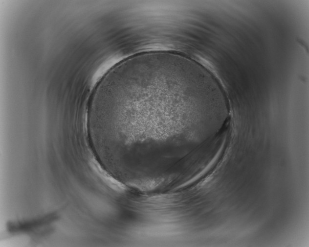 X0000099451179200805161015