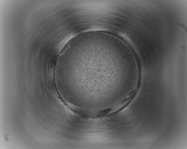 X0000099451185200805161015