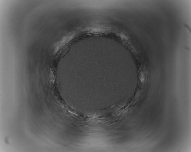 X0000099451253200805161014