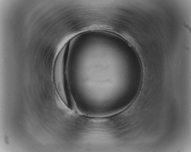 X0000099451296200805161013