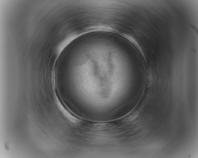 X0000099451391200805161011