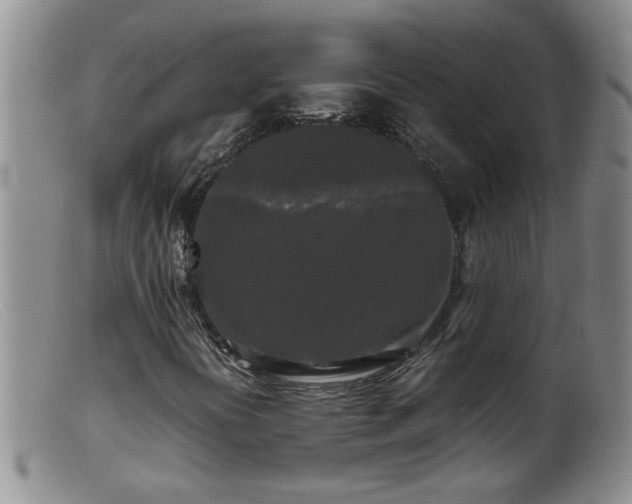 X0000099451394200805161011