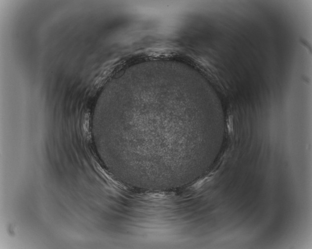 X0000099451396200805161011