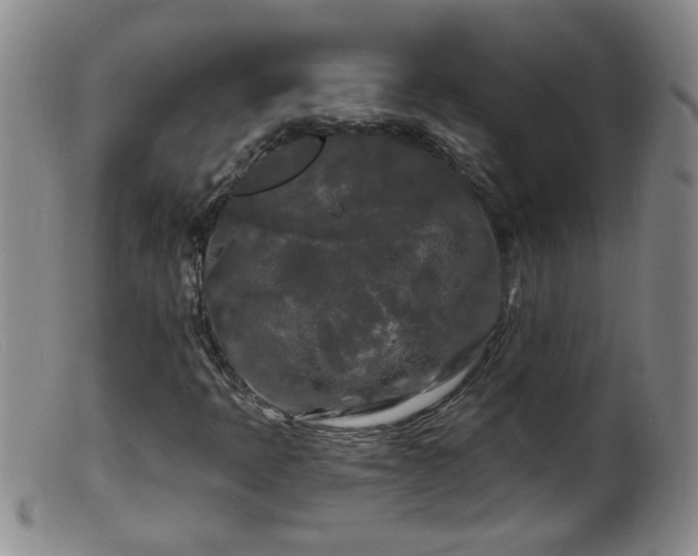 X0000099451397200805161011