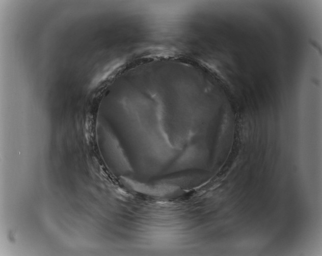 X0000099451399200805161011
